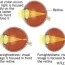 visual acuity test information mount