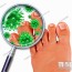 foot fungus disease with a close up of