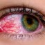 9 eye symptoms to watch out for