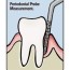 what is periodontal charting