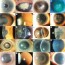 corneal dystrophies nature reviews