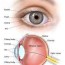 retinitis pigmentosa medlineplus genetics