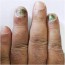 skin green diseases of the skin nails