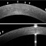 optical coherence tomography imaging