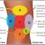 knee pain diagnosis chart knee pain
