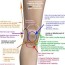 knee pain location chart the chelsea