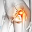 hip bone pain where is this pain