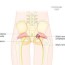 sciatica and sciatic nerve pain information