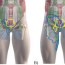 digital body mapping of pain quality