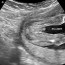 week 18 ultrasound what it would look like