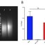 detection of telomeric dna rna hybrids