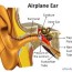 ear pain or earache can be a nightmare