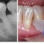 periodontology periodontal examination