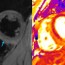 cardiac imaging in myocarditis cur