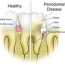 periodontal probing and charting