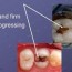 dental essment and dental charting